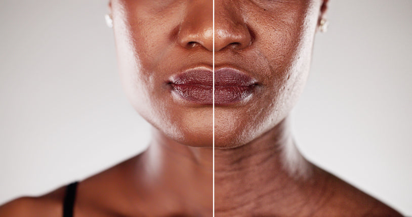 PDRN Skincare: The Regeneration Secret Your Skin Has Been Waiting For